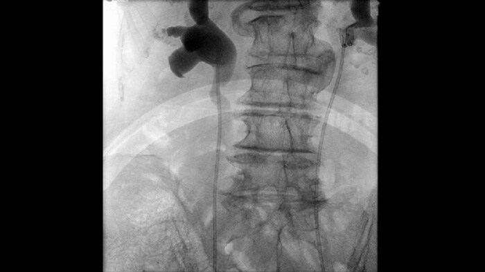 Pulsed fluoroscopy