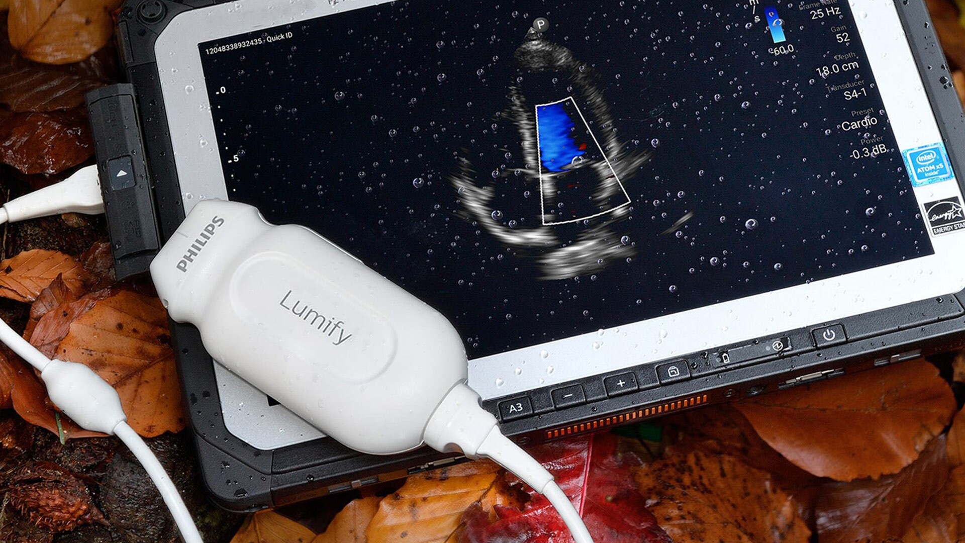 New ultrasound technology utilized to screen pregnant women at Beyond Zero Medical Safari 